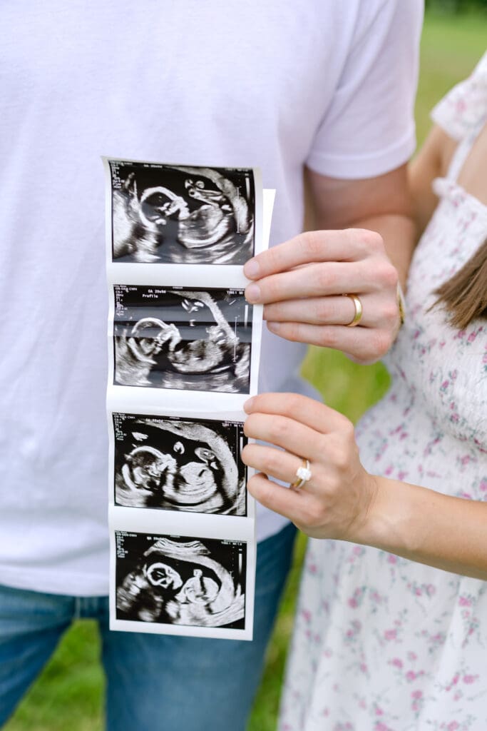 maternity photoshoot with ultrasound and wedding bands